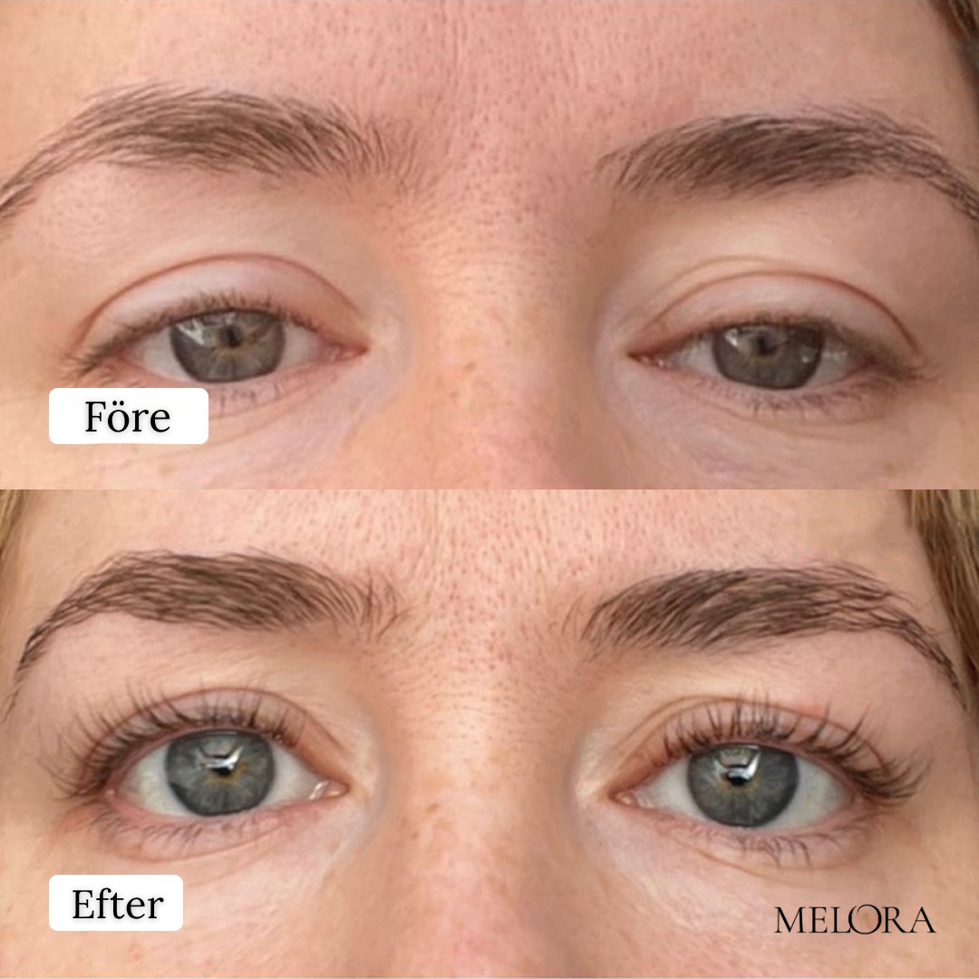 Biopeptid-serum för ögonfranstillväxt