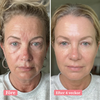 Djupt återfuktande Retinol mask