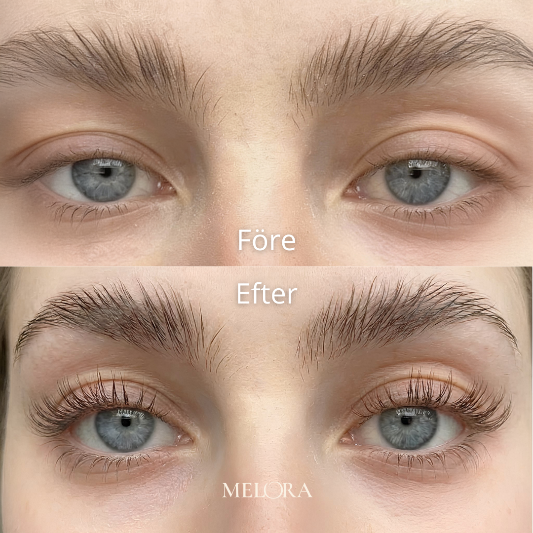 Biopeptid-serum för ögonfranstillväxt